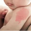 Đứa trẻ nào khi sinh ra hầu như đều có bớt trên người, nhưng nếu xuất hiện ở 10 vị trí sau báo hiệu số kiếp giàu sang