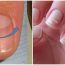 10 dấu hiệu b:;ất thường trên móng tay cảnh b.áo cơ thể đang gặp vấn đề sức khỏe