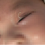 Mẹ c:;ắt móng tay văng vào mắt, cháu bé 2 tháng tuổi l:âm ng:uy