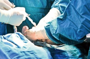 Bé trai 1 ngày tuổi không qua khỏi vì mẹ chọn sinh chủ động ở tuần 36 Bé trai 1 ngày tuổi không qua khỏi vì mẹ chọn sinh chủ động ở tuần 36