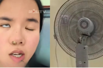 Cô gái bị liệt mặt vì bật quạt máy ngủ trưa, bác sĩ đưa ra lời cảnh báo