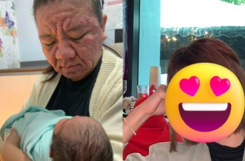 Xót xa gương mặt biến dạng sau khi mang thai của người mẹ trẻ, nhìn lại nhan sắc xinh đẹp trước đó càng không dám tin
