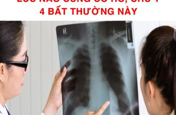 Bác sĩ cảnh báo: Ung thư phổi giai đoạn đầu không phải lúc nào cũng có ho, chú ý 4 bất thường này