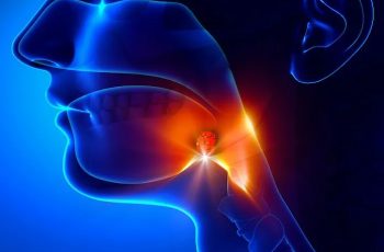 Cảnh báo: Khi thấy cơ thể có dấu hiệu này phải tới bệnh viện ngay kẻo ung thư vòm họng giai đoạn cuối