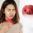 Cảnh báo: Khi thấy cơ thể có dấu hiệu này phải tới bệnh viện ngay kẻo ung thư vòm họng giai đoạn cuối