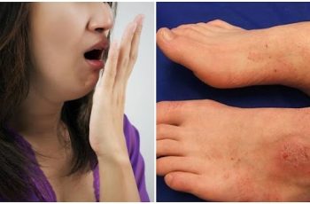 8 biểu hiện của suy thận nếu bỏ qua có thể phải chạy thận cả đời: Hôi miệng dù đã đánh răng sạch sẽ