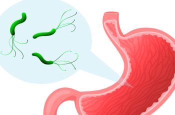 Vi khuẩn HP sợ 5 loại thực phẩm này nhất, nên ăn để bảo vệ dạ dày