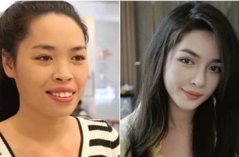 10 năm sau ca phẫu thuật “thay đổi” thành công nhất Việt Nam: Nữ chính được trao thân phận khác nhưng có 1 điều gây tiếc nuối 10 năm sau ca phẫu thuật “thay đổi” thành công nhất Việt Nam: Nữ chính được trao thân phận khác nhưng có 1 điều gây tiếc nuối