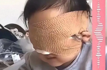 Bé gái 6 tuổi mất cả 2 mắt vì thứ nhiều bố mẹ vẫn cho con chơi mỗi ngày