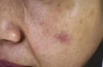 UT gan không gây đau đớn đến khi phát hiện thì đã ở giai đoạn cuối, cảnh báo 3 dấu hiệu cần đi khám gấp