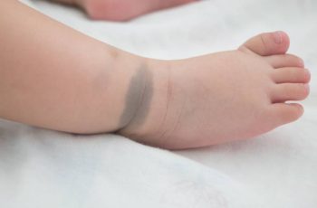 Trẻ có vết bớt ở 6 vị trí này, dự báo số mệnh thiên kim, tương lai phú quý