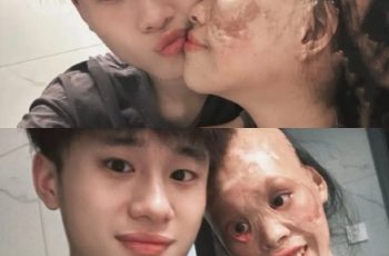 Từ bé tôi đã nổi tiếng xinh nhất vùng, nhưng một sự cố đã khiến dung nhan của tôi không còn nữa